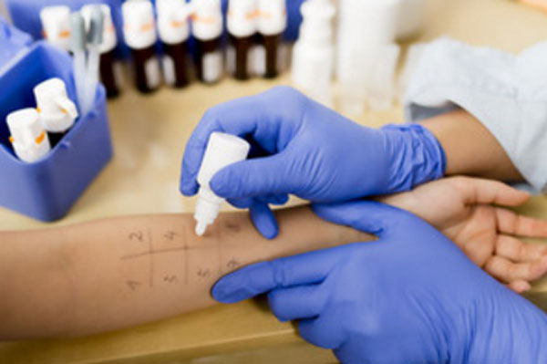 Кожный тест на алегропробы