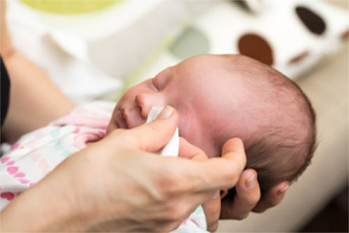 Новорожденному ребенку протирают глаза от гноя