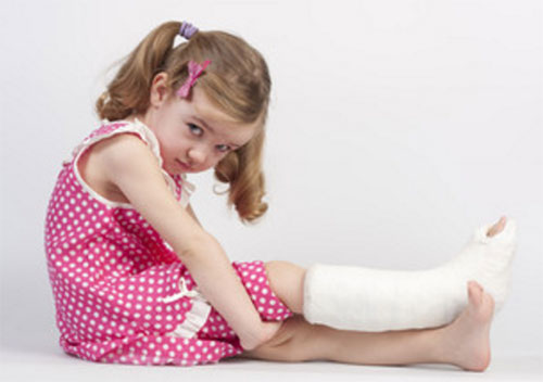 Сидит девочка с загипсованной ногой