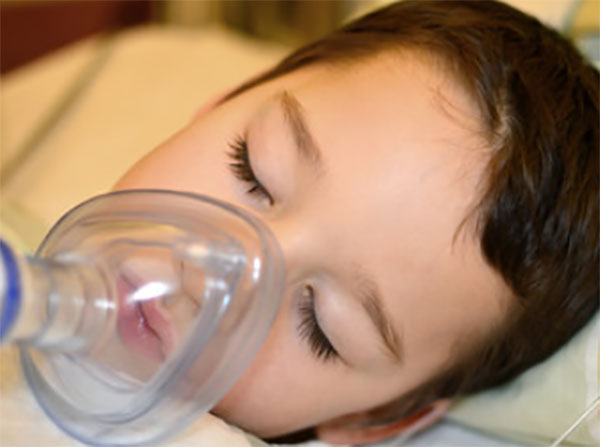 Мальчик лежит в маске с наркозом