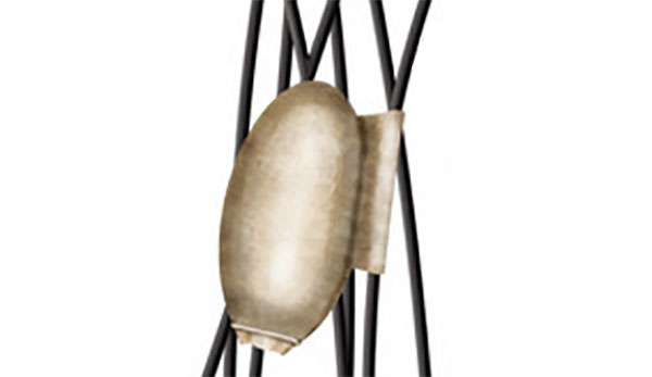 Рисунок гниды, прикрепленной к волосам