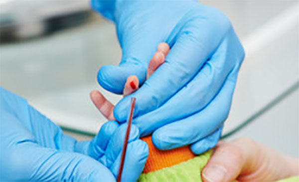 У ребенка берут из пальца кровь