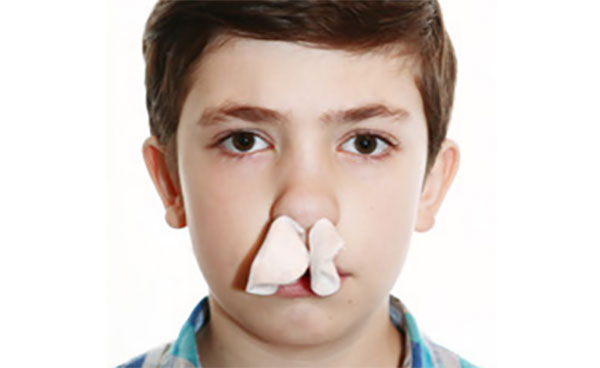 Мальчик с тампонацией носа