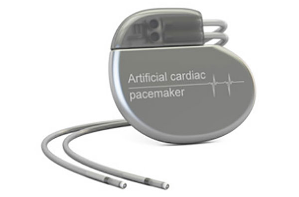 Кардиостимулятор