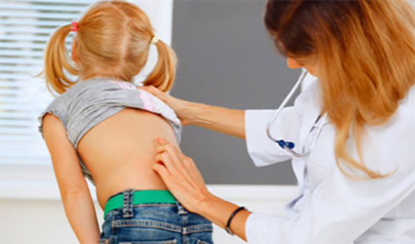 Врач диагностирует у девочки сколиоз
