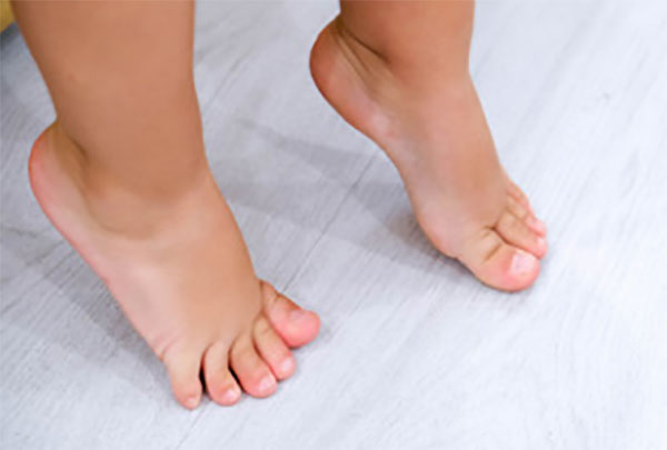 Ребенок ходит на носочках