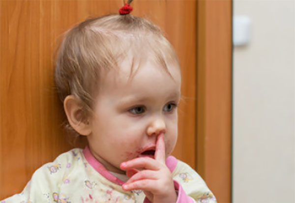 Девочка ковыряется в носу, с носика идет кровь