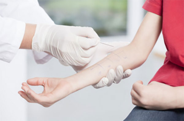 Мальчику проводят аллергопробы