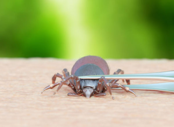 Удаление клеща с помощью пинцета