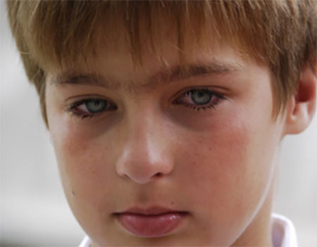 У мальчика воспалены глаза