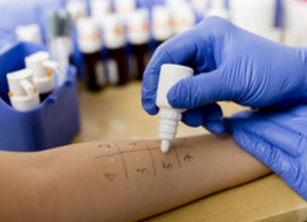 Проведение кожного теста