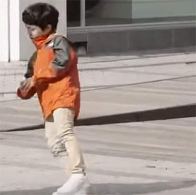 Мальчик с неровной походкой