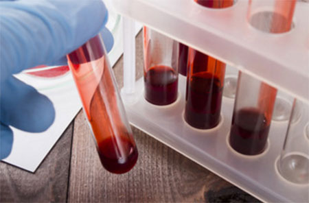 Пробирки с кровью