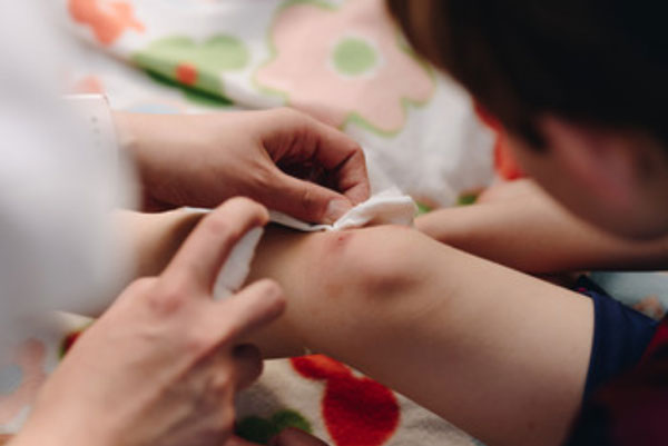 Мама обрабатывает колено антисептиком