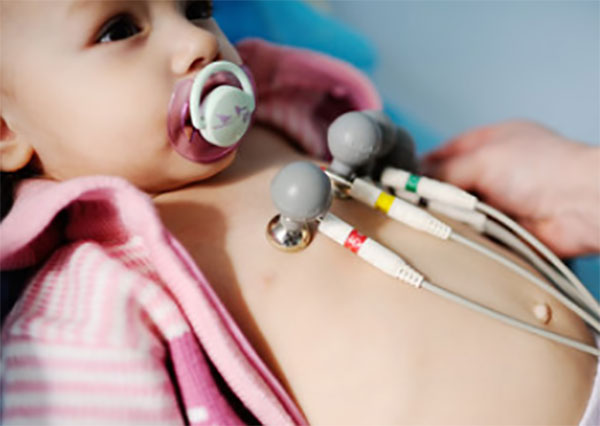 Грудному ребенку делают ЭКГ