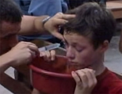 Отец промывает сыну глаза. Мальчик наклонил голову над тазиком