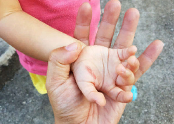 Взрослый человек держит ладонь ребенка с порезом