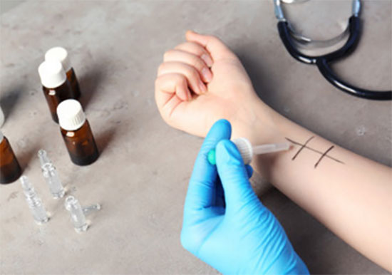 Кожный тест на выявление аллергенов