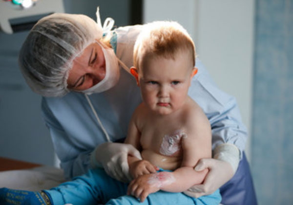 Ребенок с ожогами рядом с врачом