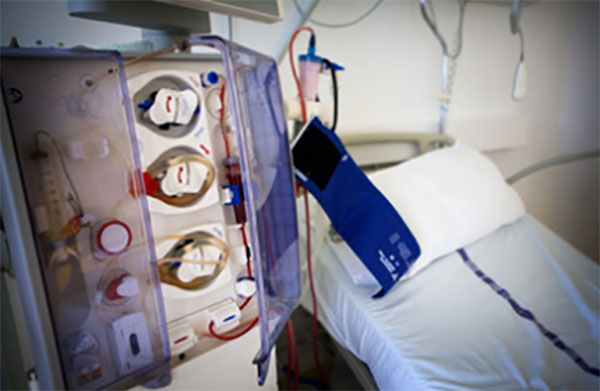 Гемодиализ