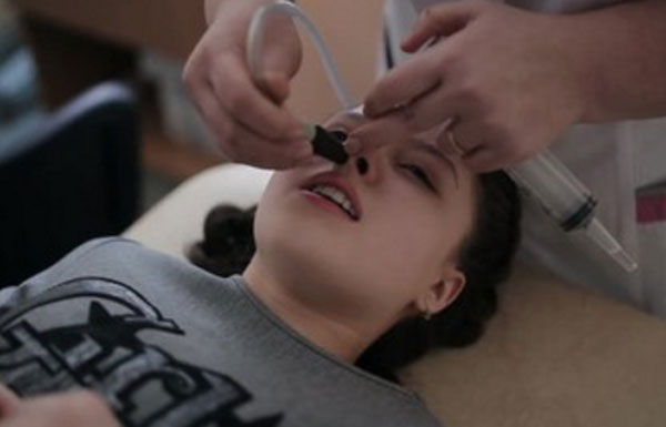 Девочке промывают нос, используя специальную трубочку и большой шприц