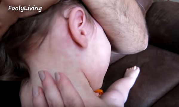 Краснуха с увеличенными лимфоузлами