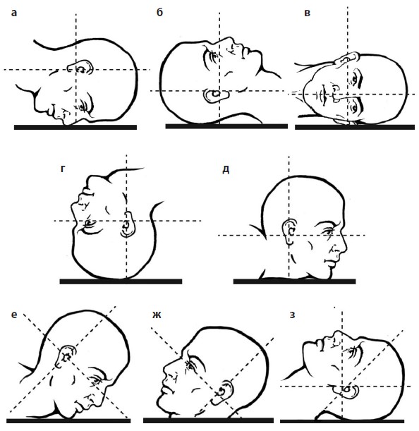 Укладки при рентгенологическом исследовании глазницы