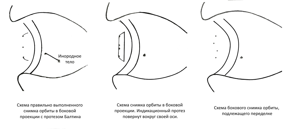 Рентгенологическое исследование в боковой проекции