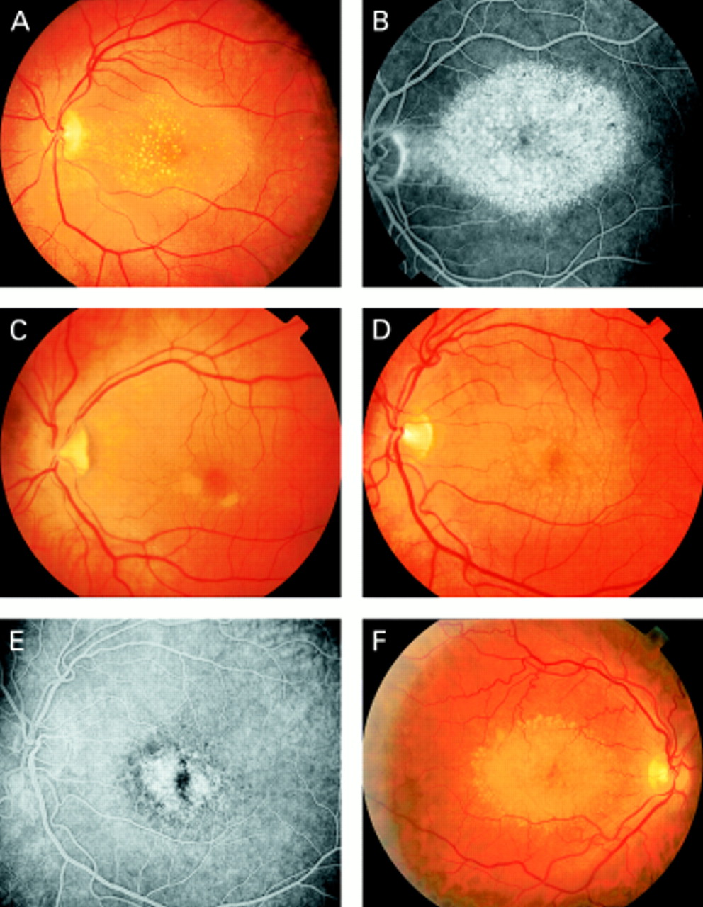 Доминантные друзы