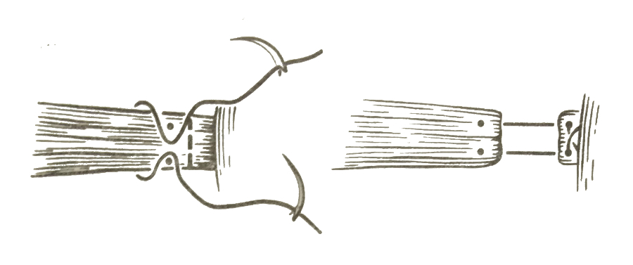 Тенотомия с предохранительным швом