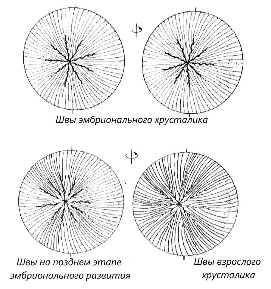 Швы хрусталика