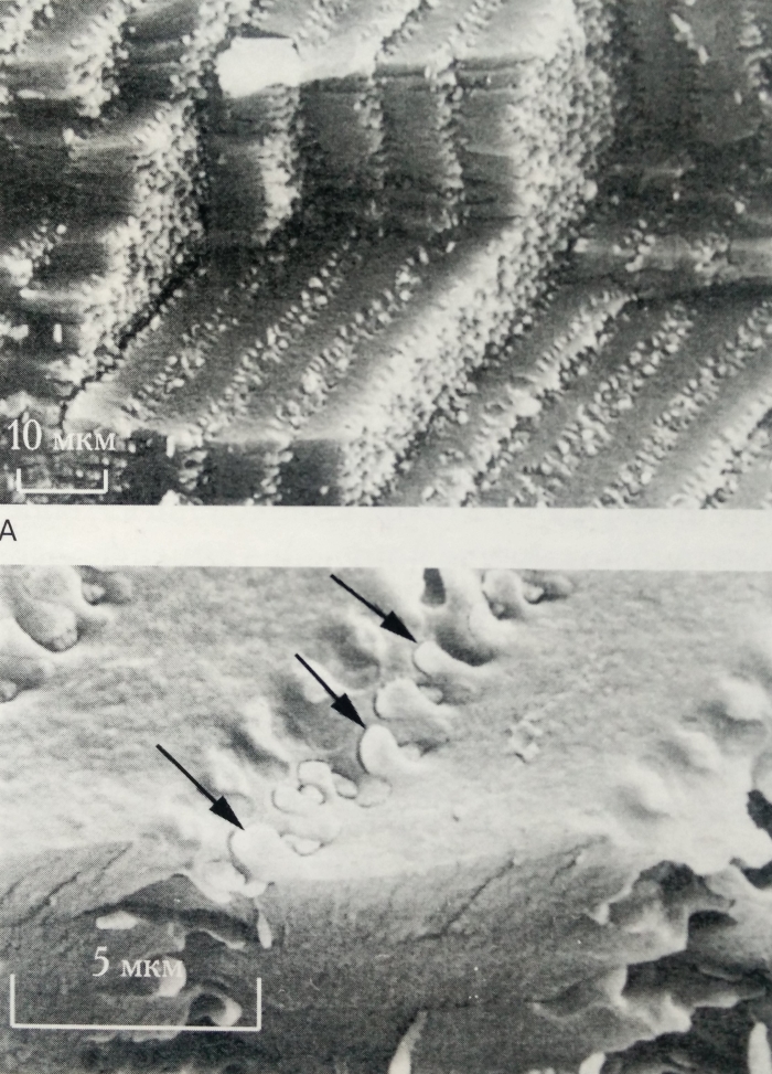 Плотно упакованные хрусталиковые волокна и контакты типы "пуговица-петля"