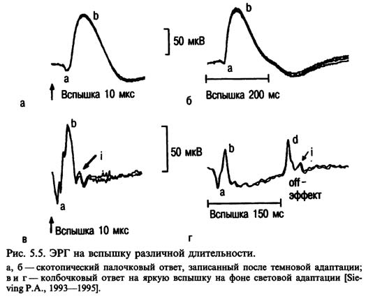 фотопическая ЭРГ