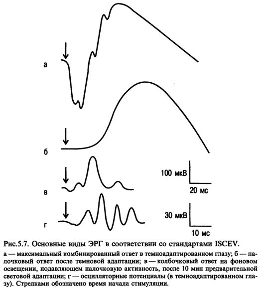 стандарты для пяти основных воспроизведений ЭРГ