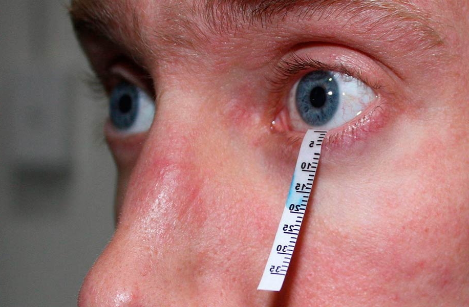 Тест Ширмера