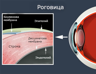 Техника Epi-Lasik