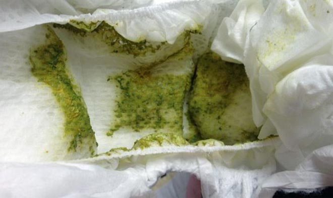 Зеленый стул зеленый жидкий стул у грудничка